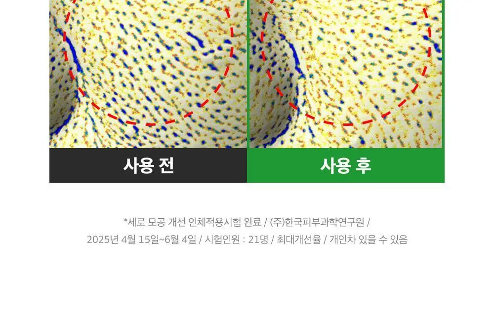 [산리오 콜라보/1등모공앰플] 성분에디터 그린토마토 NMN 포어 리프팅 앰플 40ml 더블 기획 (+산리오 빗거울) 상세페이지 9